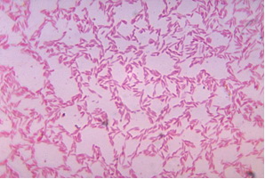 Bacteroides oralis