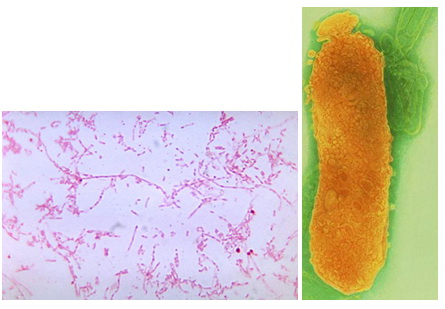 Fusobacterium necrophorum