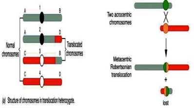 Robertsonova translokacija