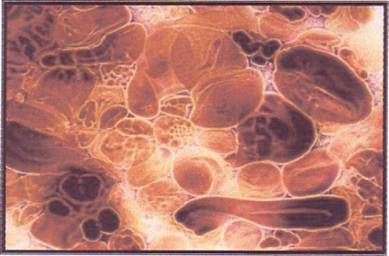 Mikroskopski izgled škrobne paste