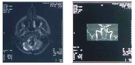 Dijagnostika MRI