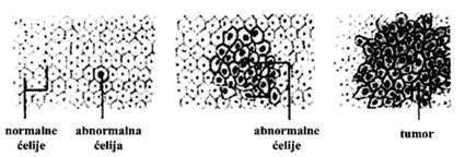 Normalne, abnormalne i celije tumora