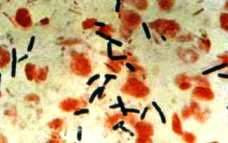 Clostridium perfingens