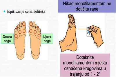 Ispitivanje senzibiliteta stopala 