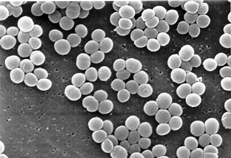 Staphylococcus aureus