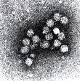 Virus hepatitisa C