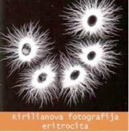 Kirilianova fotografija eritrocita