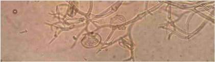 Sporangiofori i sporangiji 
